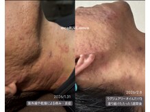 セルヴィノバ(CELL VI NOVA)/＊ビフォーアフター