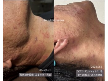 セルヴィノバ(CELL VI NOVA)/＊ビフォーアフター