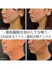 【努力不要でスッキリフェイス】小顔脂肪分解剤＋LDM水玉リフト¥15000