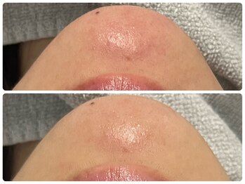 エフェクト 塚口店(effect)/before after