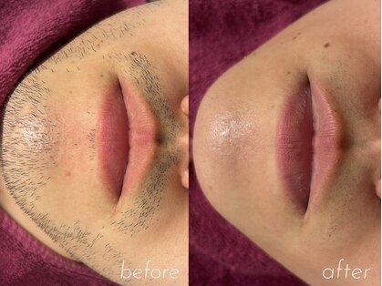 サロン エム(saron M)の写真