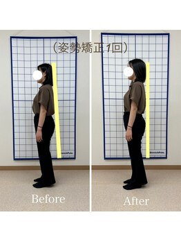 クローバー整体院/姿勢改善×美容整体(施術1回目)