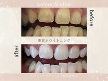 ホワイトニングショップ 福岡香椎店/美容ホワイトニングサロン