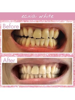 エクシアホワイト 長野店/