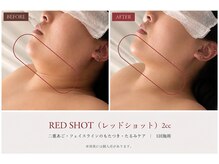 イル 名取店(iru)の雰囲気（二重あご.輪郭のもたつきが気になる方へ/リフトアップ/小顔/名取）