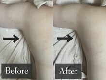 ベルフィーヌ 恵比寿店(BELFINE)/ブラの上に乗る【ハミ肉】も撃退