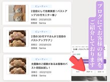 ビジュー(Be-joux)/ブログにて症例写真を掲載中♪