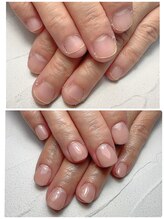 スマイルニコ(smile nico)/深爪も即日美爪にできます！