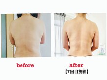 プレマータ(Prema-ta)/インドエステでサイズダウン！