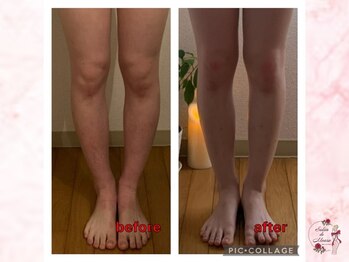 サロンドモアロ(Salon de Moaro)/Before/After