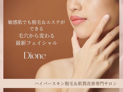 ディオーネ(DIONE)の写真