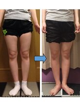 プラスファイン(+fine)/おすすめO脚矯正。前