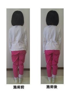 整体処たまゆら/体の歪みビフォーアフター