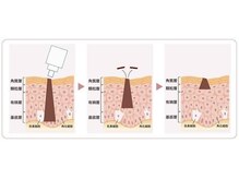 セゾン(Saison)/シミ排出メカニズムの秘密
