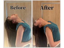 整体ラルース 中目黒(LALUZ)/30代 女性 ストレートネック改善