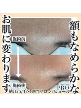 ピュール 鯖江店(PUR)/毛穴サロン/毛穴ケア/毛穴洗浄