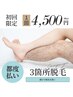 お好きな3箇所脱毛★足や腕など気になるところからはじめれる¥7000→¥4500