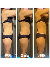 ボディケアアップ(BODY CARE UP↑)/WINBACK上半身メニュー