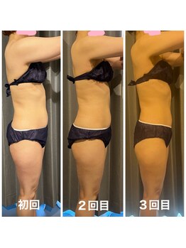 ボディケアアップ(BODY CARE UP↑)/WINBACK上半身メニュー