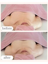 ワム(Wom)/産後・授乳後左右差施術1回/30代