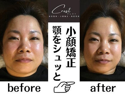 クレスト(CREST)の写真