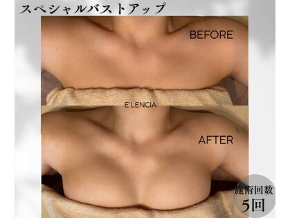 エレンシア(E'lencia)の写真