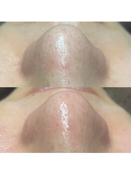 スウィートマジョラム(Sweet Marjoram)/毛穴洗浄肌質改善