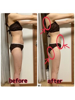 ヨサパーク カズリー(YOSA PARK kazury)/ルルオン前後の変化です!