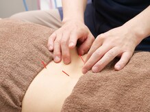 ジョイプラス川西鍼灸整骨院(joyplus.川西鍼灸整骨院)/腰痛改善