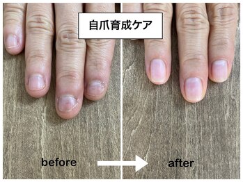 コバコ(kobaco)/弄り癖改善　8ヶ月の成果比較