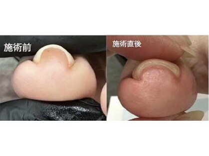 ジェインズネイル(J's-nail)の写真