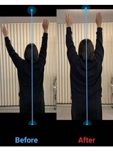 りらく整体 あおば/肩の挙上制限にアプローチ