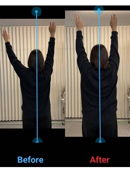 りらく整体 あおば/肩の挙上制限にアプローチ