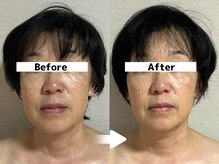 メイヴィ 四日市(Maivi)/50代女性の変化