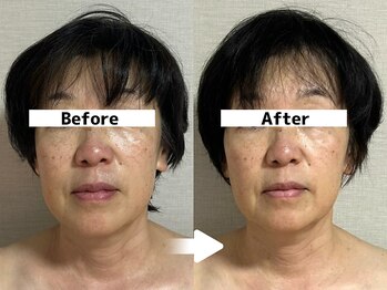 メイヴィ 四日市(Maivi)/50代女性の変化