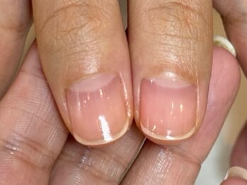 ネイルケア・ハンドケア