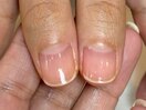 ネイルケア・ハンドケア