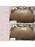 【毛穴・くすみ改善】内側から発光するような水光肌へ　19800円→18000円