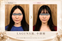 ラグナ(LAGUNA)