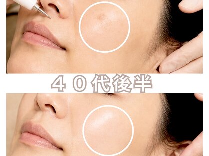 からだ美人 ヘッドスパ 鹿児島の写真
