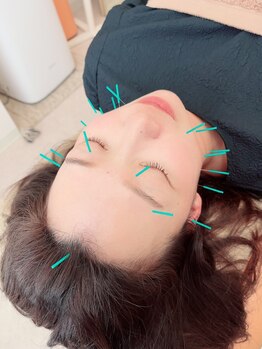 ヒーリングサロン アージュ(A-je)/★美顔鍼＋小顔矯正★