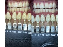 トウキョウスワーズ 池袋店(TOKYO SWRS)/#ホワイトニング #池袋 #渋谷