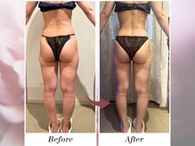 リボーン(boju reborn)/◆30代のお客様◆