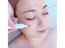 キラリ(kirari)の雰囲気（あなたに合ったシミケアをしていきます）