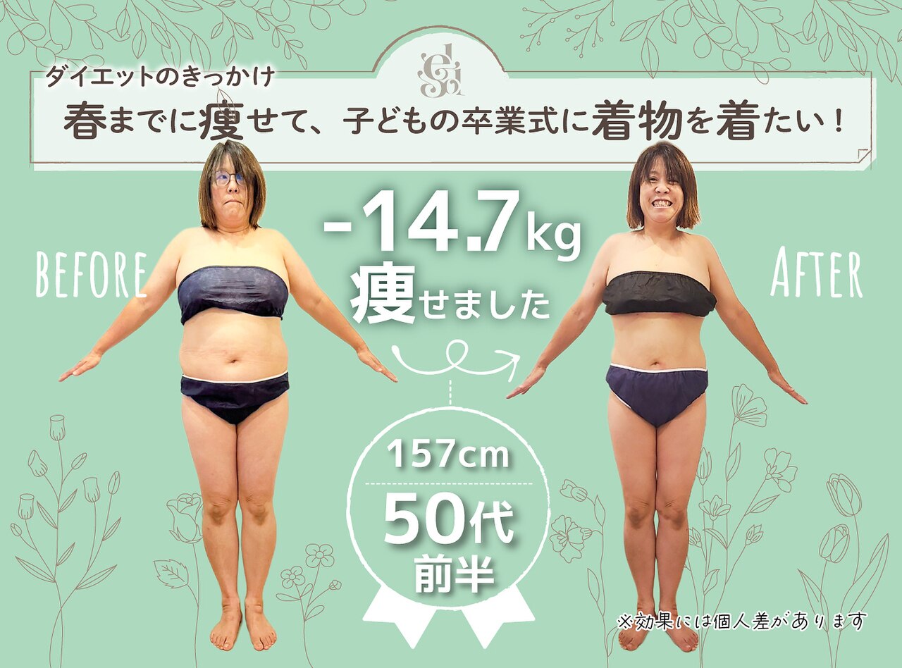 若江岩田駅でダイエットが人気のエステサロン｜ホットペッパービューティー