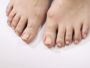 イズ(...is)の写真/【フットケアができるサロン】夏に向けて足の指先もスッキリ◎