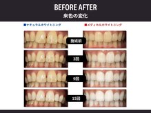 メンズフェイスラボ 本町 阿波座(MEN'S Face Labo)の雰囲気（結果重視ホワイトニング◎[眉毛/眉毛サロン/アイブロウ/心斎橋]）
