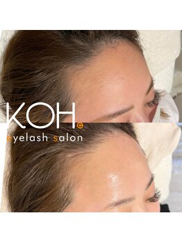 コウ 甲子園口店(KOH)/フェイスワックス♪