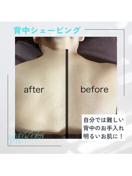 モアプラス(MORE plus)/背中シェービング