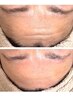 【毛穴の黒ずみ・ザラつきにはコレ！】スキンケアWaxxxxでツルスベたまご肌へ